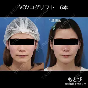 もとび美容外科クリニック 新宿院 西尾 謙三郎医師の症例
