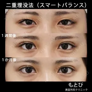 もとび美容外科クリニック 新宿院 西尾 謙三郎医師の症例