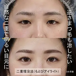 もとび美容外科クリニック 新宿院 西尾 謙三郎医師の症例