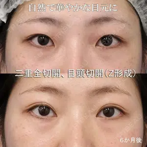 もとび美容外科クリニック 新宿院 西尾 謙三郎医師の症例