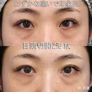 もとび美容外科クリニック 新宿院 西尾 謙三郎医師の症例