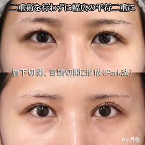 もとび美容外科クリニック 新宿院 西尾 謙三郎医師の症例