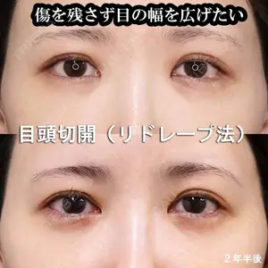 もとび美容外科クリニック 新宿院 西尾 謙三郎医師の症例