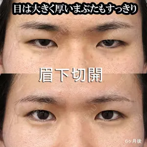 もとび美容外科クリニック 新宿院 西尾 謙三郎医師の症例