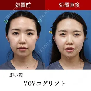 もとび美容外科クリニック 新宿院 西尾 謙三郎医師の症例