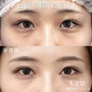 もとび美容外科クリニック 新宿院 西尾 謙三郎医師の症例
