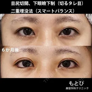 もとび美容外科クリニック 新宿院 西尾 謙三郎医師の症例