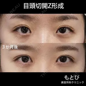 もとび美容外科クリニック 新宿院 西尾 謙三郎医師の症例