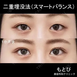 もとび美容外科クリニック 新宿院 西尾 謙三郎医師の症例