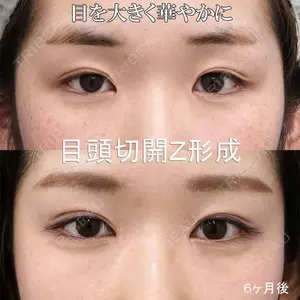 もとび美容外科クリニック 新宿院 西尾 謙三郎医師の症例