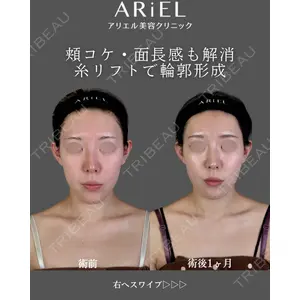 アリエル美容クリニック 郡山院 安齋 誠基医師の症例