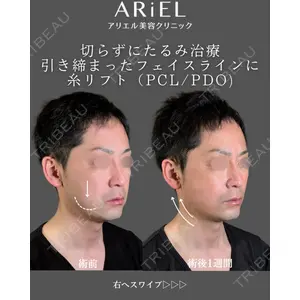 アリエル美容クリニック 郡山院 安齋 誠基医師の症例
