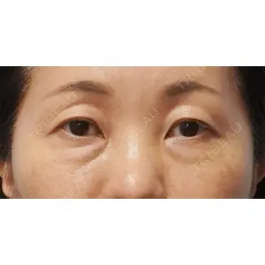 麹町皮ふ科・形成外科クリニックの症例