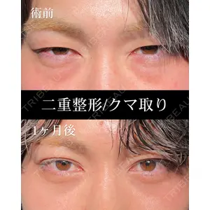 HAAB BEAUTY CLINIC 名古屋院 丸山 舜大医師の症例