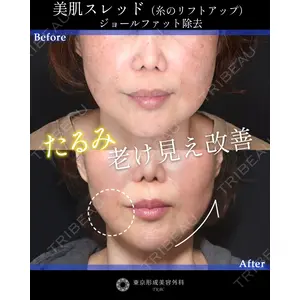 東京形成美容外科 船橋院 山崎 修吾医師の症例