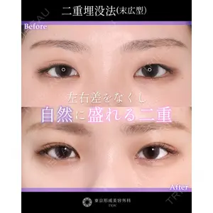 東京形成美容外科 銀座院 中尾 真紀医師の症例