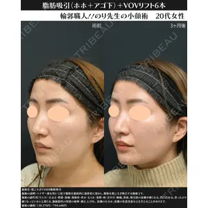 湘南美容クリニック 川崎院 伊藤 賀敏医師の症例