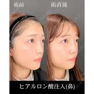 HAAB×DREAM BEAUTY CLINIC 大阪梅田院 錦 実奈医師の症例