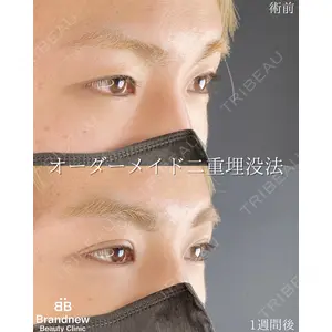 Brandnew Beauty Clinicの症例