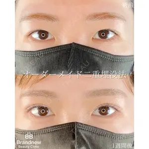 Brandnew Beauty Clinicの症例