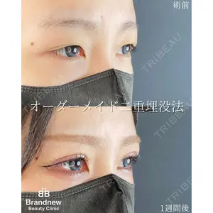 Brandnew Beauty Clinic 平山 容成医師の症例