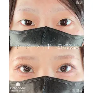 Brandnew Beauty Clinicの症例