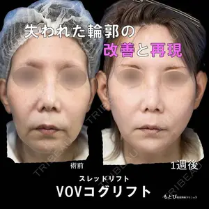 もとび美容外科クリニック 新宿院 西尾 浩二郎医師の症例