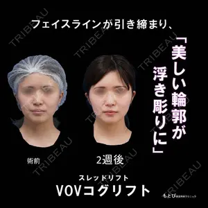 もとび美容外科クリニック 新宿院 西尾 浩二郎医師の症例