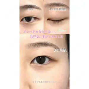 もとび美容外科クリニック 新宿院 西尾 浩二郎医師の症例
