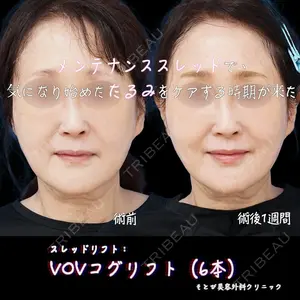 もとび美容外科クリニック 新宿院 西尾 浩二郎医師の症例