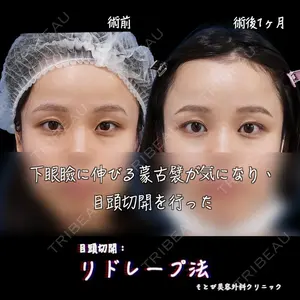 もとび美容外科クリニック 新宿院 西尾 浩二郎医師の症例