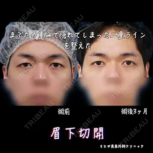 もとび美容外科クリニック 新宿院 西尾 浩二郎医師の症例
