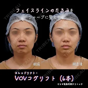 もとび美容外科クリニック 新宿院 西尾 浩二郎医師の症例