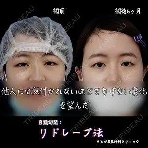もとび美容外科クリニック 新宿院 西尾 浩二郎医師の症例