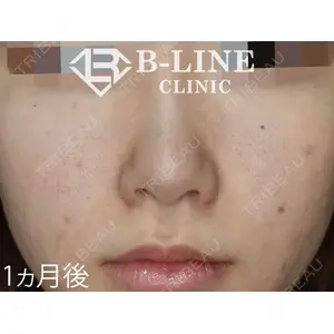 B-LINE CLINIC 池袋院 小池 康弘医師の症例