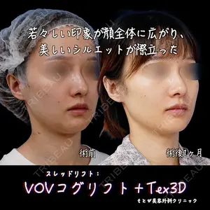 もとび美容外科クリニック 新宿院 西尾 浩二郎医師の症例
