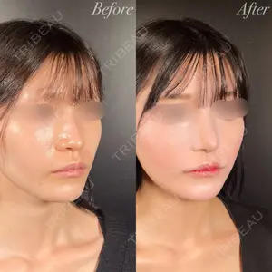 R Beauty CLINIC 銀座院 吉田　慧医師の症例