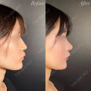 R Beauty CLINIC 銀座院 吉田　慧医師の症例