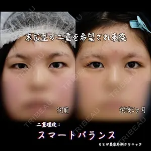 もとび美容外科クリニック 新宿院 西尾 浩二郎医師の症例