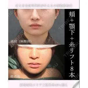 ヴェルトラクリニック 新宿院 伊藤　優医師の症例