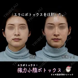 もとび美容外科クリニック 新宿院 西尾 浩二郎医師の症例