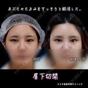 もとび美容外科クリニック 新宿院 西尾 浩二郎医師の症例