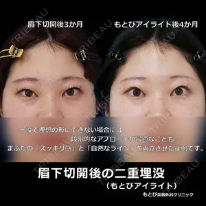 もとび美容外科クリニック 新宿院 西尾 浩二郎医師の症例