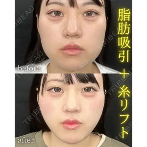 THE FIRST CLINIC 町田院 木暮 啓一郎医師の症例