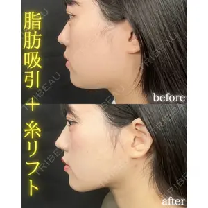 THE FIRST CLINIC 町田院 木暮 啓一郎医師の症例