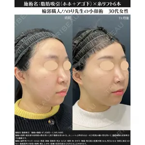湘南美容クリニック 川崎院 伊藤 賀敏医師の症例
