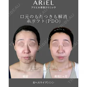 アリエル美容クリニック 郡山院 安齋 誠基医師の症例