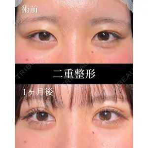 HAAB BEAUTY CLINIC 名古屋院 丸山 舜大医師の症例