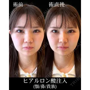 HAAB×DREAM BEAUTY CLINIC 東京本院 佐野 圭医師の症例