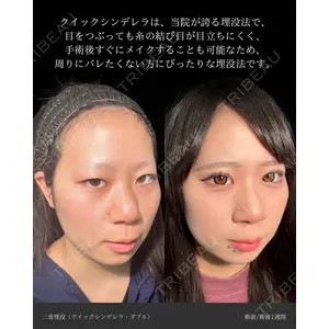 東京シンデレラ美容外科 大宮院 竹田 昌平医師の症例